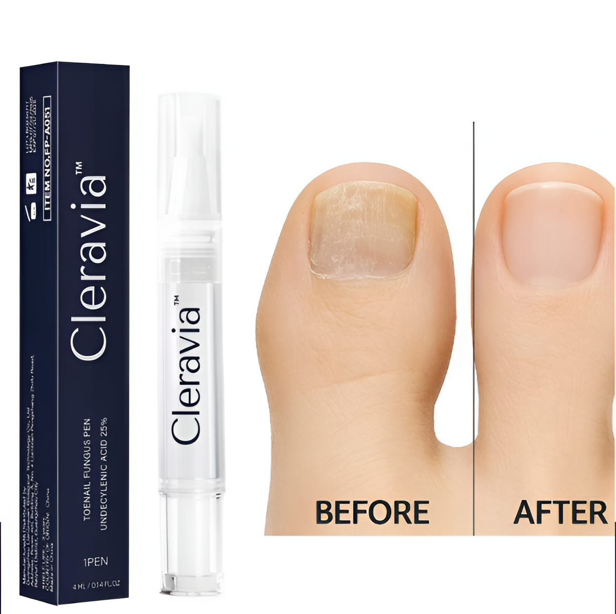 Cleravia™ Antifungal Pen - 25% Undecylenic Acid